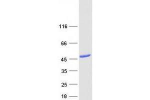 Western Blotting (WB) image for Paraneoplastic Antigen MA2 (PNMA2) protein (Myc-DYKDDDDK Tag) (ABIN2729237)