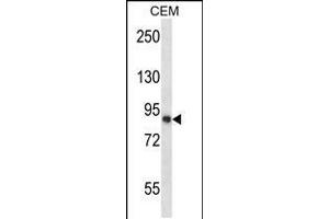 Western blot analysis in CEM cell line lysates (35ug/lane). (CAPN11 抗体  (AA 409-438))