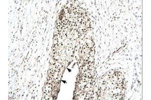 Image no. 1 for anti-RuvB-Like 2 (E. Coli) (RUVBL2) (N-Term) antibody (ABIN202582) (RUVBL2 抗体  (N-Term))