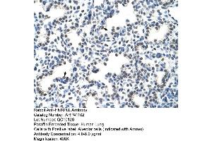 Rabbit Anti-HNRPLL Antibody  Paraffin Embedded Tissue: Human Lung Cellular Data: Alveolar cells Antibody Concentration: 4. (HNRPLL 抗体  (N-Term))