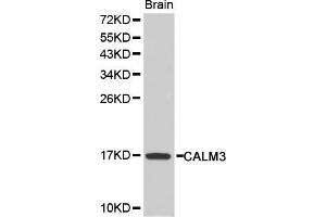 Western blot analysis of extracts of mouse brain, using CALM3 antibody (ABIN5970507). (Calmodulin 3 抗体)