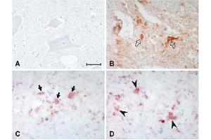 Immunhistochemistry image of HHE-histidine adduct staining in paraffn sections of spinal cords of amyotrophic lateral sclerosis (ALS) patients. (4-Hydroxy-2-Hexenal (4-HHE) 抗体)