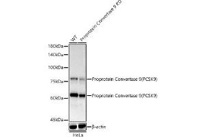Western blot analysis of extracts of HeLa cells, using Proprotein Convertase 9(PCSK9) antibody  at 1:1000 dilution. (PCSK9 抗体)