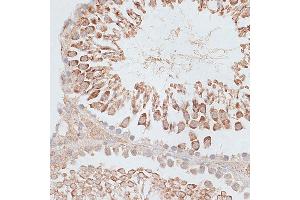 Immunohistochemistry of paraffin-embedded Rat testis using KIF2C/MCAK antibody (ABIN6128155, ABIN6142869, ABIN6142870 and ABIN6221103) at dilution of 1:100 (40x lens). (KIF2C 抗体  (AA 1-190))