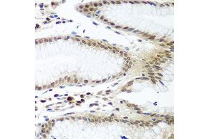 Immunohistochemistry of paraffin-embedded human stomach using PTTG1 antibody at dilution of 1:100 (40x lens). (PTTG1 抗体)