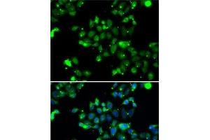 Immunofluorescence analysis of A-549 cells using U2AF1L4 Polyclonal Antibody (Splicing factor U2AF 26 kDa subunit (U2AF1L4) 抗体)