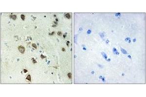 Immunohistochemistry analysis of paraffin-embedded human brain tissue, using S6K-alpha6 Antibody.