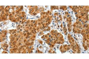 Immunohistochemistry (Paraffin-embedded Sections) (IHC (p)) image for anti-Collagen, Type I, alpha 2 (COL1A2) antibody (ABIN7234801)