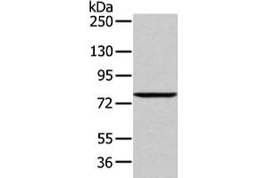 Gel: 6 % SDS-PAGE, Lysate: 60 μg, Lane: 293T cell, Primary antibody: ABIN7193043(WDR91 Antibody) at dilution 1/400 dilution, Secondary antibody: Goat anti rabbit IgG at 1/8000 dilution, Exposure time: 1 minute (WDR91 抗体)