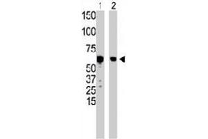 The GCK polyclonal antibody  is used in Western blot to detect GCK in HepG2 cell lysate (Lane 1) and mouse liver tissue lysate (Lane 2) . (GCK 抗体  (N-Term))