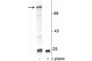 Western blot of UV treated human Jurkat cell lysate showing specific immunolabeling of the ~74 kDa Raf-1 protein phosphorylated at Ser301 in the first lane (-). (RAF1 抗体  (pSer301))