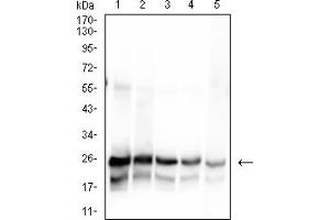 Western blot analysis using SARS-Cov2-NP1 mAb against human SARS-Cov2-N (AA: 1-180) recombinant protein. (SARS-Cov2-NP1 (AA 1-180) 抗体)