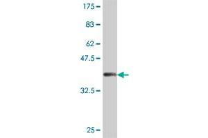 Western Blot detection against Immunogen (38. (PNMT 抗体  (AA 1-110))