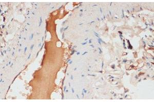 Immunohistochemistry of paraffin-embedded Human lung using APOC1 Polyclonal Antibody at dilution of 1:100 (40x lens). (APOC1 抗体)