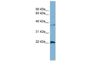 WB Suggested Anti-RAN Antibody Titration: 0. (RAN 抗体  (Middle Region))