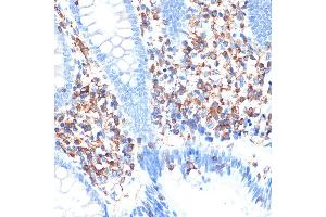 Immunohistochemistry of paraffin-embedded human appendix using ELMO1 Rabbit mAb (ABIN7266951) at dilution of 1:100 (40x lens). (ELMO1 抗体)