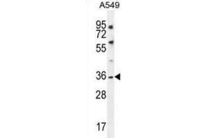 Western Blotting (WB) image for anti-Potassium Channel Subfamily K Member 1 (KCNK1) antibody (ABIN2996574) (KCNK1 抗体)