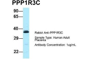 Host: Rabbit  Target Name: PPP1R3C  Sample Tissue: Human Adult Placenta  Antibody Dilution: 1. (PPP1R3C 抗体  (N-Term))