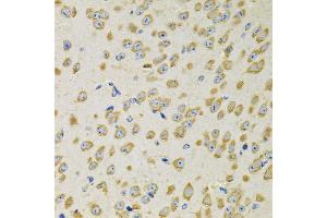 Immunohistochemistry of paraffin-embedded mouse brain using ADSS antibody. (ADSS 抗体)