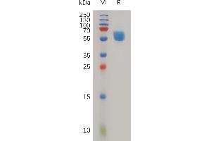 SDS-PAGE (SDS) image for Triggering Receptor Expressed On Myeloid Cells 1 (TREM1) (AA 21-200) protein (Fc Tag) (ABIN7491115)