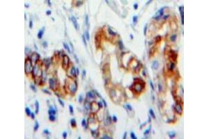 Used in DAB staining on fromalin fixed paraffin-embedded Stomach tissue (CD36 抗体  (AA 187-428))