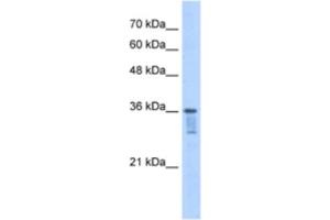 Western Blotting (WB) image for anti-Leucine Zipper Transcription Factor-Like 1 (LZTFL1) antibody (ABIN2463178) (LZTFL1 抗体)