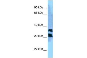 WB Suggested Anti-PGP Antibody Titration: 1. (PGP 抗体  (C-Term))