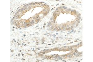 Immunohistochemistry (IHC) image for anti-Ribosomal Protein S5 (RPS5) (AA 1-50) antibody (ABIN7455001) (RPS5 抗体  (AA 1-50))