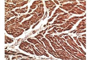 Immunohistochemical analysis of paraffin-embedded Human Heart Tissue using VE-Cadherin Mouse mAb diluted at 1:200. (Cadherin 5 抗体  (AA 670-750))