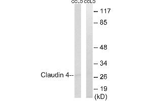 Immunohistochemistry analysis of paraffin-embedded human brain tissue, using Claudin 4 (Ab-208) antibody. (Claudin 4 抗体  (Internal Region))