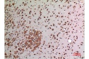 Immunohistochemistry (IHC) analysis of paraffin-embedded Rat Brain, antibody was diluted at 1:100. (FGF20 抗体  (Internal Region))