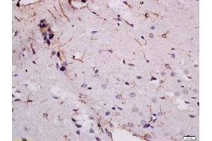 Formalin-fixed and paraffin embedded rat brain labeled with Rabbit Anti-MDGA2 Polyclonal Antibody, Unconjugated  at 1:200 followed by conjugation to the secondary antibody and DAB staining (MDGA2 抗体  (AA 751-850))