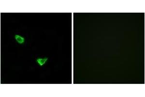 Immunofluorescence analysis of MCF7 cells, using CHSY2 Antibody. (CHPF 抗体  (AA 631-680))