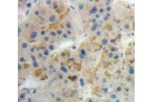 Used in DAB staining on fromalin fixed paraffin-embedded Liver tissue (GIP 抗体  (AA 22-153))