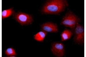 Immunofluorescence (IF) image for anti-Cofilin 1 (CFL1) (AA 1-166) antibody (APC) (ABIN5566999) (Cofilin 抗体  (AA 1-166) (APC))