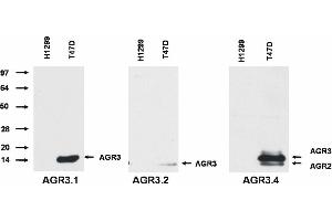 Western blotting analysis of AGR3 protein by AGR3. (AGR2+AGR3 抗体)