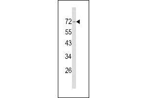 Western blot analysis of Merlin Antibody (N-term) (ABIN390756 and ABIN2841014) in NCI- cell line lysates (35 μg/lane). (Merlin 抗体  (N-Term))
