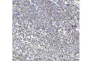 IHC analysis of MCM7 using anti-MCM7 antibody (ABIN7601968). (MCM7 抗体  (AA 526-719))