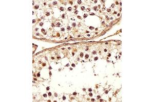 Immunohistochemical analysis of paraffin-embedded H. (DEFB107A 抗体  (C-Term))