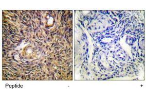 Immunohistochemistry analysis of paraffin-embedded human ovary tissue using ACO1 polyclonal antibody . (Aconitase 1 抗体)