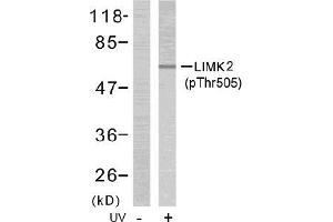 Image no. 1 for anti-LIM Domain Kinase 2 (LIMK2) (pThr505) antibody (ABIN196833) (LIMK2 抗体  (pThr505))