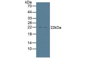 Figure. (BID 抗体  (AA 1-195))