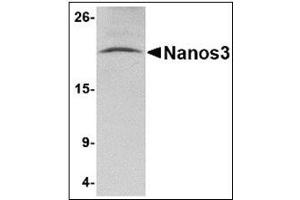 Western blot analysis of Nanos3 in human brain tissue lysate with Nanos3 antibody at 2 µg/ml. (NANOS3 抗体  (C-Term))