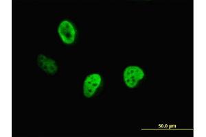 Immunofluorescence of monoclonal antibody to CUTL1 on HeLa cell. (CUX1 抗体  (AA 521-620))