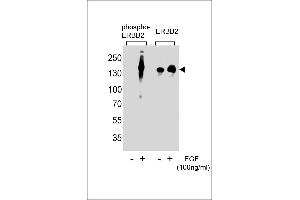 Western blot analysis of extracts from A431 cells,untreated or treated with EGF,100 ng/mL , using phospho-ERBB2-(left) or ERBB2 Antibody (right) (ErbB2/Her2 抗体  (pTyr1248))