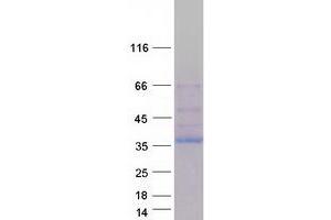 Western Blotting (WB) image for NIMA (Never in Mitosis Gene A)-Related Kinase 6 (NEK6) (Transcript Variant 5) protein (Myc-DYKDDDDK Tag) (ABIN2727083)