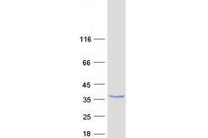 Validation with Western Blot (LYSMD1 Protein (Transcript Variant 1) (Myc-DYKDDDDK Tag))