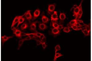 Immunofluorescence (fixed cells) (IF/ICC) image for anti-ATP-Binding Cassette, Sub-Family A (ABC1), Member 8 (ABCA8) (Internal Region) antibody (ABIN6257916)