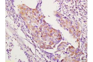 Immunohistochemistry (Paraffin-embedded Sections) (IHC (p)) image for anti-Tumor Necrosis Factor Receptor Superfamily, Member 4 (TNFRSF4) (AA 101-200) antibody (ABIN749108)