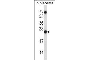 RNASE8 Antibody (C-term) (ABIN657386 and ABIN2846428) western blot analysis in human placenta tissue lysates (35 μg/lane). (RNASE8 抗体  (C-Term))